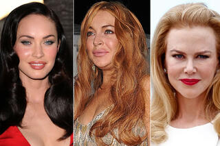 Ces stars ont abusé du Botox !