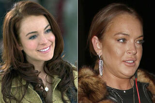 Ces stars ont abusé du Botox !