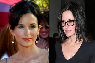 Ces stars ont abusé du Botox !